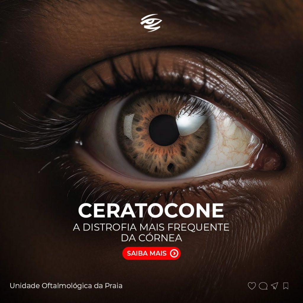 Social Media Oftalmologia da Praia